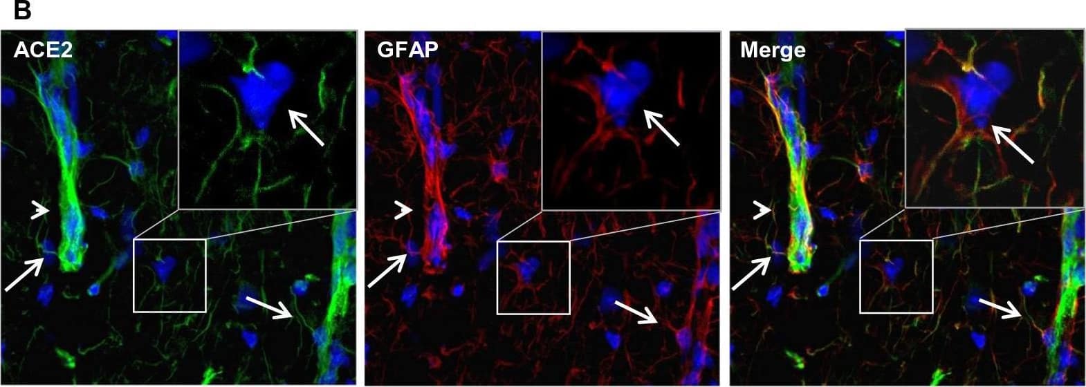 Differential distribution of ACE2 in brain parenchyma. A Uneven distribution of ACE2 (green) in indicated brain regions. Each insert shows a comparable high magnitude image of the corresponding region. B Enlarged images of the indicated region in the MY panel in A with co-staining of ACE2 (green) and astrocyte marker GFAP (red). C Co-staining of ACE2 (red) and neuron marker NeuN (green) in the MY. Cii-Civ show the high magnitude image of the comparable regions of Ci. D Quantitation of the relative expression of ACE2 in astrocytes and neurons. Values are presented as mean ± SEM. n = 60. ***: p < 0.001. DAPI (blue) was used for nuclear staining. Arrowhead: indicates microvessel. Arrow: indicates astrocyte. Dash arrow: indicates neuron. #indicates meninges wrapping MY. Image magnitude A and Ci: 20X, B and Cii-iv: 100X Image collected and cropped by CiteAb from the following open publication (//pubmed.ncbi.nlm.nih.gov/35672716), licensed under a CC-BY license. Not internally tested by R&D Systems.