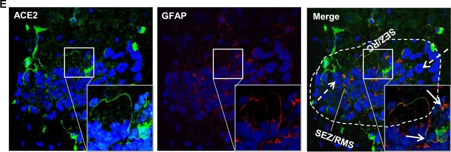 Distribution of ACE2 along the olfactory retrograde route. A Schematic elucidation of a gross view of mouse olfactory retrograde route comprised by OB surface, SEZ/RC, SEZ in the rostral migratory stream (SEZ/RMS) and SVZ of the LV (top panel) and a microscopic view of SEZ/RC and SEZ/RMS (bottom panel). B–E Co-staining of ACE2 (green) with astrocyte marker GFAP (red) in SEZ/RC and SEZ/RMS. B-C show the low magnitude images. D–E show the enlarged images of the indicated regions in B and C, respectively. DAPI (blue) was used for nuclear staining. Arrow: indicates astrocyte. Dash arrow: indicates neuroblast. Arrowhead: indicates microvessel. The dash lines in all images outline the border of SEZ/RC and SEZ/RMS, respectively. Image magnitude B-C: 20X, D-E: 100X Image collected and cropped by CiteAb from the following open publication (//pubmed.ncbi.nlm.nih.gov/35672716), licensed under a CC-BY license. Not internally tested by R&D Systems.