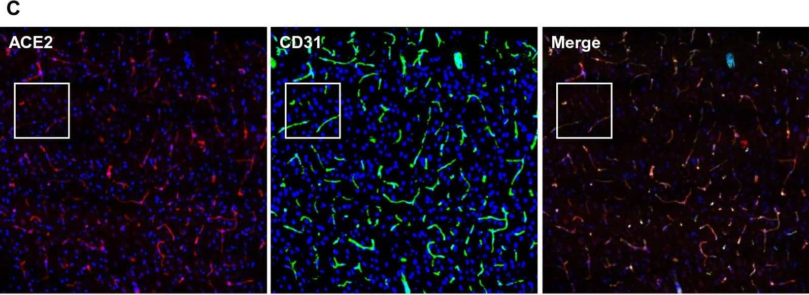 Ubiquitous expression of ACE2 in cerebral microvascular pericytes. A Schematic elucidation of sectioning plates and main brain regions of a mouse brain. OB: olfactory bulb, SEZ/RC: subependymal zone (SEZ) in the rhinocele, CTX: cerebral cortex, CC: corpus callosum, STR: striatum, LV: lateral ventricle, HP: hippocampus, TH: thalamus, 3 V: third ventricle, HY: hypothalamus, AQ: cerebral aqueduct, MB: midbrain, CB: cerebellum, 4 V: fourth ventricle, MY: medulla oblongata. B Scanning images show ACE2 (green) distribution in the hemisphere sections. C–F ACE2 (red) ubiquitously distributes in the cerebral microvessels labeled by endothelial cell marker CD31 (green) and pericyte marker PDGFR beta  (green), respectively. ACE2 overlapped with pericyte marker PDGFR beta  (F) but not endothelial cell marker CD31 (D). C and E showed the low magnitude images. D and F showed the enlarged images of the indicated regions in C and E, respectively. G ACE2 (red) does not distribute in large blood vessels marked by CD31 (green) but is detectable in the meninges wrapping HY. DAPI (blue) was used for nuclear staining. *: indicates large blood vessels. #: indicates meninges. Arrowhead: indicates microvessel. Image magnitude B: 10X; C, E and G: 20X; D and F: 100X Image collected and cropped by CiteAb from the following open publication (//pubmed.ncbi.nlm.nih.gov/35672716), licensed under a CC-BY license. Not internally tested by R&D Systems.