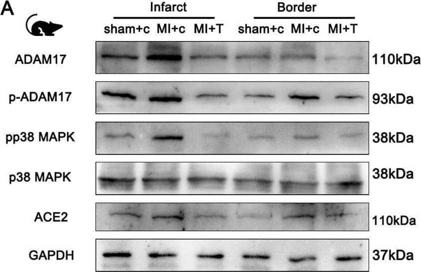 ADAM17 deletion reduces ACE2 shedding in post-MI mice. Knockout of ADAM17 in the myocardium of MI mice using TAPI-1, the same as before. A Western blot analysis of the expression of ADAM17, p-ADAM17, pP38MAPK, total P38MAPK, ACE2 protein in different position myocardium of 30 days post-MI mice. B Quantification of pP38MAPK levels in different position of myocardium. C Quantification of ACE2 levels in cardiomyocytes. D Detection of ACE2 activity in cardiomyocyte lysates by ACE2 activity fluorometric assay. E Detection of pADAM17 Thr735 expression in peripheral blood of patients with or without HF after MI. F Detection of ACE2 expression in peripheral blood of patients with or without HF after MI. N = 6 biological replicates. Data shown as mean ± SEM. Derived by two-sample t-test, *P < 0.05; **P < 0.01, ***P < 0.001 Image collected and cropped by CiteAb from the following open publication (//pubmed.ncbi.nlm.nih.gov/37046278), licensed under a CC-BY license. Not internally tested by R&D Systems.