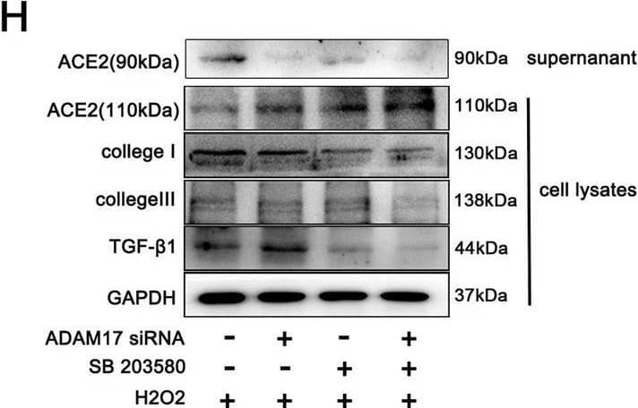 Activated P38MAPK induced phosphorylation of ADAM17 in injured cardiomyocyte. A–C Representative western blot (A) and quantitative results depicting the phosphorylation vs. total protein levels of P38 (B) and ERK1/2 (C) in H9C2 cardiomyocytes treated with 600 μM hydrogen peroxide for 12 h (n = 3). D Phosphorylated ADAM17 (p-ADAM17) was assessed by western blot with anti-phospho-ADAM17 (pThr735) antibody after transfection with ADAM17 siRNA or P38MAPK inhibitor SB203580 as indicated (n = 3). E Flow cytometric analysis of annexin V/PI double stained cardiomyocyte after treatment as indicated (right). Histogram indicating the percentage of later apoptosis cells in 4 groups (left) (n = 3). F The cell viability was detected by CCK8 assay (n = 4). G The live (green) and dead (red) cells were observed by calcein-AM/PI double staining kit after treatment as indicated (right). Histogram showing percentage of viable cells(left) (n = 3). H Protein levels of ACE2 (110 kDa), collagen I, collagen III TGF-beta 1 in cardiomyocytes and released ACE2 protein (90 kDa) in the supernatant were detected by western blotting(n = 3). I, J ACE2 activity in cardiomyocyte lysates (I) and cardiomyocyte supernatant (J) was detected by the ACE2 Activity Fluorometric Assay(n = 4). Data shown as mean ± SEM. Derived by two-sample t-test, *P < 0.05; **P < 0.01, ***P < 0.001 Image collected and cropped by CiteAb from the following open publication (//pubmed.ncbi.nlm.nih.gov/37046278), licensed under a CC-BY license. Not internally tested by R&D Systems.