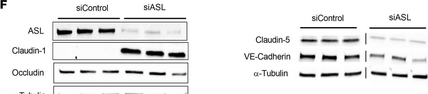 ASL knockdown in HBMECs leads to reduced NO signaling, decreased paracellular permeability, and dysregulated expression of BBB-associated genes.(A) Relative mRNA expression of ASL in HBMECs 2 days after transfection with control and ASL siRNAs (siControl and siASL) (n = 3). (B) Intracellular levels of NO in siControl and siASL-transfected HBMECs as measured by DAF-FM diacetate fluorescence assay (n = 9). (C) Intracellular cGMP levels in siControl and siASL-transfected HBMECs as measured by ELISA (n = 5). (D) Quantitative analysis of TEER level at 1–3 days after transfected HBMECs were seeded on Transwell inserts (n = 3). (E) Relative mRNA expression of CLDN5, CDH5, TJP1, OCLN, and CLDN1 in HBMECs 2 days after siRNA-mediated knockdown (n = 3). (F) Western blot analysis of ASL, CLDN1, OCLN, CLDN5, and VE-Cadherin protein levels in HBMECs 2 days after siControl and siASL transfection. Samples were run on 2 separate gels, and  alpha -Tubulin was used as the internal control (n = 3). (G) Protein abundance was quantitatively measured after normalization to  alpha -Tubulin level. Bar graphs represent mean values while error bars represent the standard deviation. *P < 0.05, **P < 0.01, and ***P < 0.001. Student’s t test. A.U., arbitrary units. Image collected and cropped by CiteAb from the following open publication (//pubmed.ncbi.nlm.nih.gov/37490345), licensed under a CC-BY license. Not internally tested by R&D Systems.