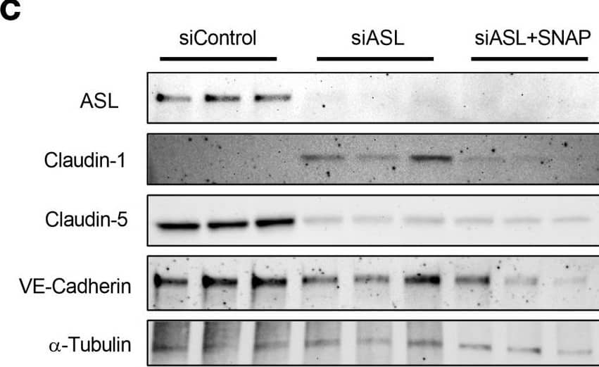 Treatment with an NO donor or Claudin-1 inhibition improved barrier integrity in ASL-deficient HBMECs.(A) TEER measurement in HBMECs treated with 0, 10, or 25 μM of S-nitroso-N-acetylpenicillamine (SNAP), an NO donor, 48 hours (hr) after subculture (n = 3). (B) Comparison of TEER levels in HBMECs treated with 25 μM of either N-acetylpenicillamine (NAP) or SNAP 48 hr after subculture. SNAP or NAP was added daily, starting 24 hr after subculture (n = 3). (C) Western blot analysis and (D) quantification investigating the effects of SNAP (25 μM) on expression of ASL, CLDN5, CLDN1, and VE-Cadherin in ASL-deficient HBMECs (n = 3). SNAP was added to the treatment group 24 hr prior to protein extraction. (E) Relative mRNA expression of CLDN1 in HBMECs 48 hr after transfection with siControl, siASL, or both siASL and siCLDN1 (n = 3). (F) Western blot analysis and (G) quantification to assess ASL, CLDN5, and CLDN1 protein level in HBMECs 48 hr after siRNA transfection (n = 3). Protein abundance was normalized to  alpha -Tubulin level in D and G. (H) TEER measurement to investigate the effects of SNAP (25 μM) or siRNA-mediated inhibition of CLDN1 on paracellular barrier integrity of ASL-deficient HBMECs. Bar graphs represent mean values while error bars represent the standard deviation. *P < 0.05, **P < 0.01, and ***P < 0.001. One-way ANOVA, multiple comparisons. Image collected and cropped by CiteAb from the following open publication (//pubmed.ncbi.nlm.nih.gov/37490345), licensed under a CC-BY license. Not internally tested by R&D Systems.