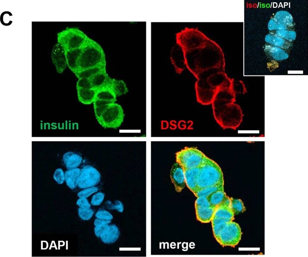 Immunocytochemistry/ Immunofluorescence Desmoglein-2 Antibody [Unconjugated]