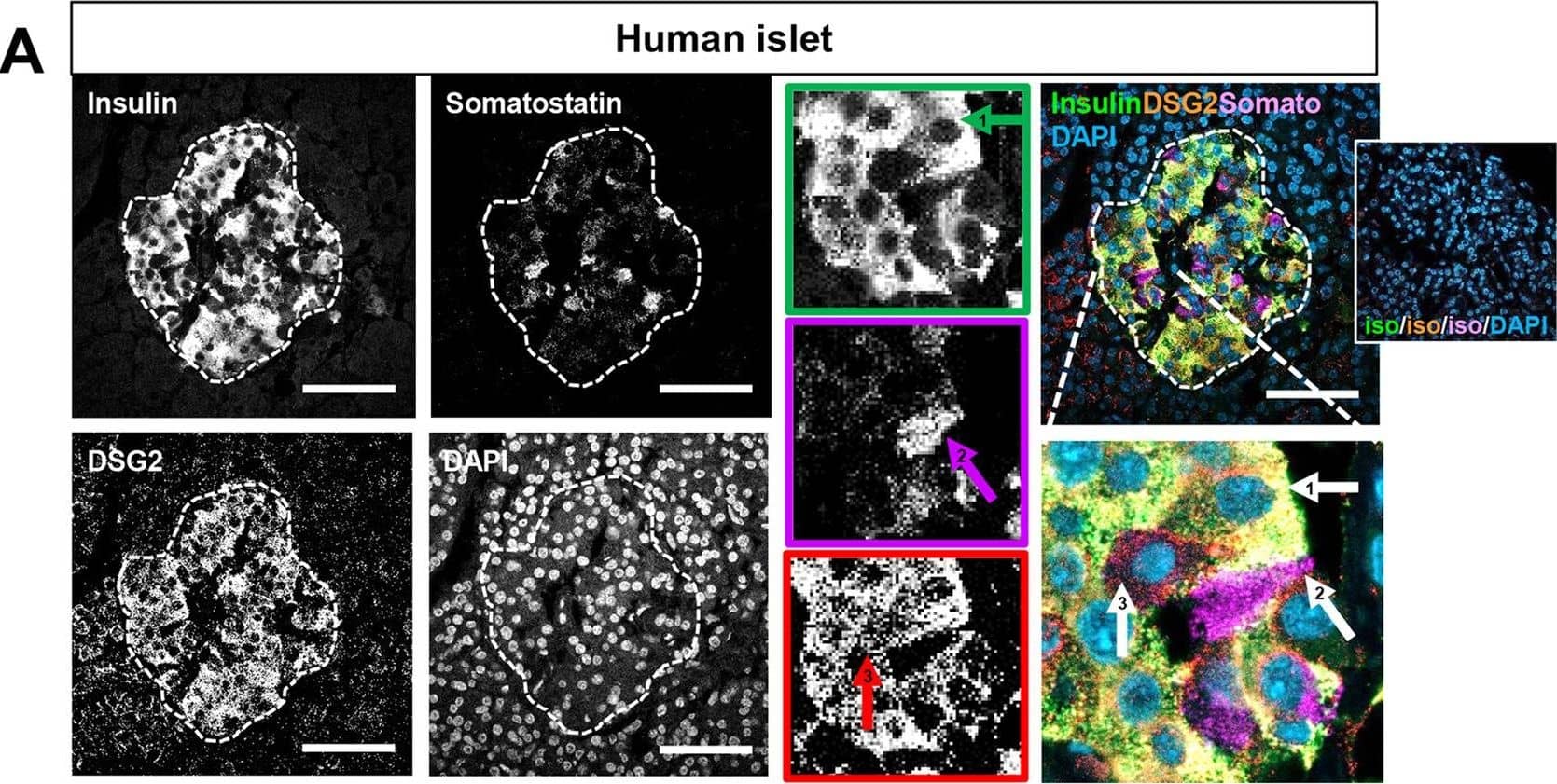Immunohistochemistry Desmoglein-2 Antibody [Unconjugated]
