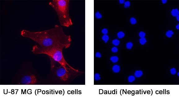 Cathepsin B was detected in immersion fixed U‑87 MG human glioblastoma/astrocytoma cell line (Positive) & absent in Daudi human Burkitt's lymphoma cell line (Negative) using Goat Anti-Human Cathepsin B Antigen Affinity-purified Polyclonal Antibody (Catalog # AF953) at 5 &micro;g/mL for 3 hours at room temperature. Cells were stained using the NorthernLights&trade; 557-conjugated Anti-Goat IgG Secondary Antibody (red; Catalog # NL001) and counterstained with DAPI (blue). Specific staining was localized to cell surface. View our protocol for Fluorescent ICC Staining of Cells on Coverslips.