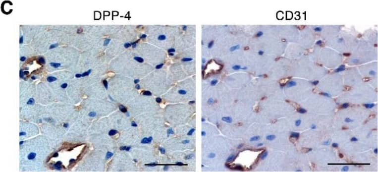 At human Cmax equivalent, linagliptin indirectly increases Ser16 phosphorylation of the Ca2+ handling protein phospholamban in cardiomyocytes. (A) Immunoblotting for serine 16 phosphorylated phospholamban (PLN(Ser16)) in heart homogenates of young, non-diabetic adult mice perfused with Krebs Henseleit buffer (KHB) or KHB supplemented with 9 nmol/L linagliptin and subjected to 20 min no-flow ischemia followed by 40 min reperfusion (n = 6/group). (B) Immunoblotting primary cultured mouse cardiomyocytes for PLN(Ser16) under control conditions or after incubation with 9 nmol/L linagliptin for 5 min (n = 13/condition). (C) Serial cut sections from a C57BL/6 mouse heart immunostained for DPP-4 or CD31 showing predominant DPP-4 expression in CD31+ cells indicative of endothelial expression (n = 4). Scale bar = 50 µm. (D–F) Volcano plots of differentially expressed genes determined by RNA sequencing of adult mouse cardiomyocytes derived from young, non-diabetic, non-high fat diet-fed mice (D; n = 5/condition) or aged, diabetic, high fat diet-fed (DM-HFD) mice (E; n = 3/condition) exposed to linagliptin (9 nmol/L) or vehicle for 24 h. (F) Volcano plot of differentially expressed genes in vehicle-treated cardiomyocytes derived from DM-HFD mice (n = 3) and control mice (n = 5). Values are mean ± S.D.. *p < 0.05 by two-tailed Student’s t-test. Image collected and cropped by CiteAb from the following open publication (//pubmed.ncbi.nlm.nih.gov/32796688), licensed under a CC-BY license. Not internally tested by R&D Systems.