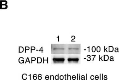 Linagliptin promotes NO-mediated endothelial-cardiomyocyte communication. (A) Immunoblotting showing absence of DPP-4 in primary cultured mouse cardiomyocytes (mouse duodenum = positive control). (B) Immunoblotting C166 endothelial cell lysates for DPP-4 (1 and 2 are replicates). (C and D) Immunoblotting C166 mouse endothelial cells for phospho-Akt (Ser473) (C) or phospho-eNOS (Ser1177) (D) after incubation with 9 nmol/L linagliptin for 5 min (control, n = 8, linagliptin, n = 6). (E) Immunoblotting adult mouse cardiomyocytes for PLN(Ser16) after exposure to 100 µmol/L S-nitroso-N-acetylpenicillamine (SNAP) for 5 min (vehicle, n = 6; SNAP, n = 7). (F) cGMP concentration in adult mouse cardiomyocytes under control conditions or after incubation with 9 nmol/L linagliptin for 5 min (n = 4/condition). (G) (Left) Co-culture experiment in which adult mouse cardiomyocytes were cultured in the presence of C166 endothelial cells in cell culture inserts before the addition of linagliptin. (Right) cGMP concentration in adult mouse cardiomyocytes co-cultured with C166 endothelial cells under control conditions or after incubation with 9 nmol/L linagliptin for 5 min. Values are mean ± S.D.. * p < 0.05, ** p < 0.01 by the two-tailed Student’s t-test. Image collected and cropped by CiteAb from the following open publication (//pubmed.ncbi.nlm.nih.gov/32796688), licensed under a CC-BY license. Not internally tested by R&D Systems.
