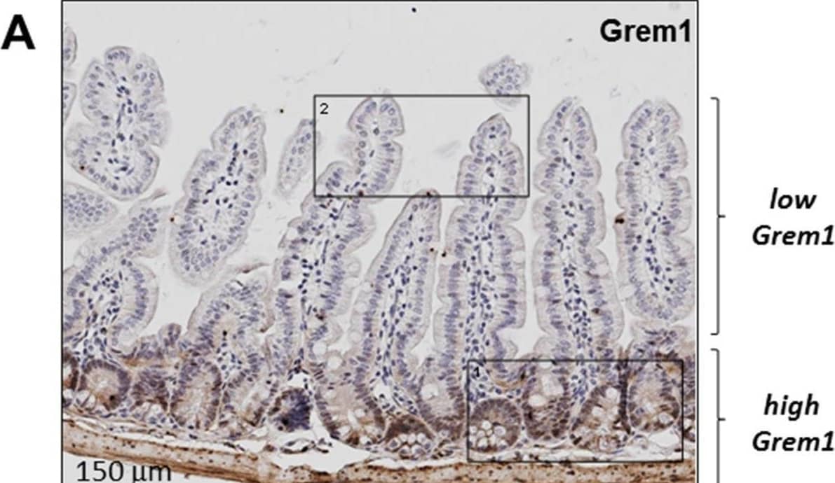 Immunohistochemistry Gremlin 1 Antibody [Unconjugated]