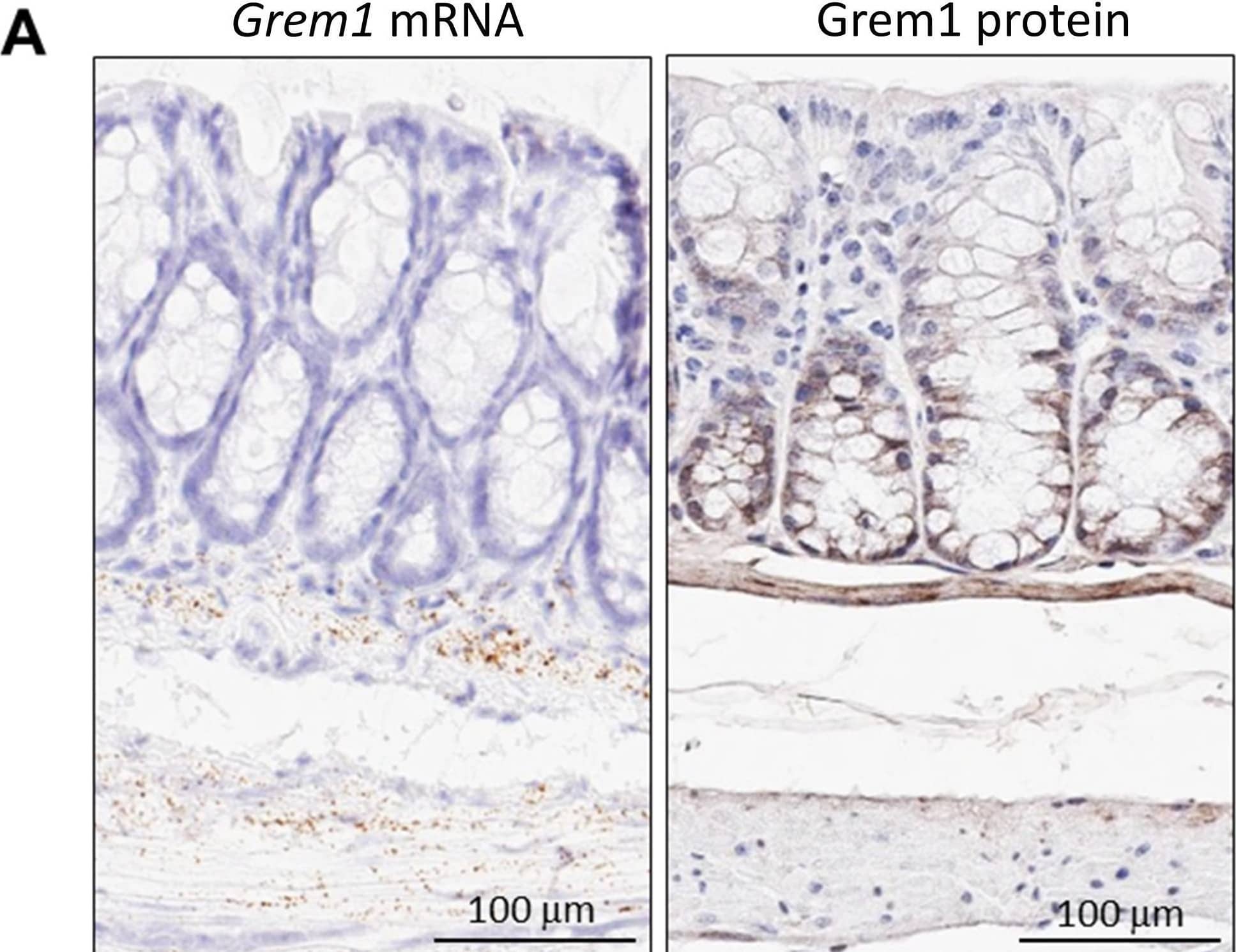 Immunohistochemistry Gremlin 1 Antibody [Unconjugated]