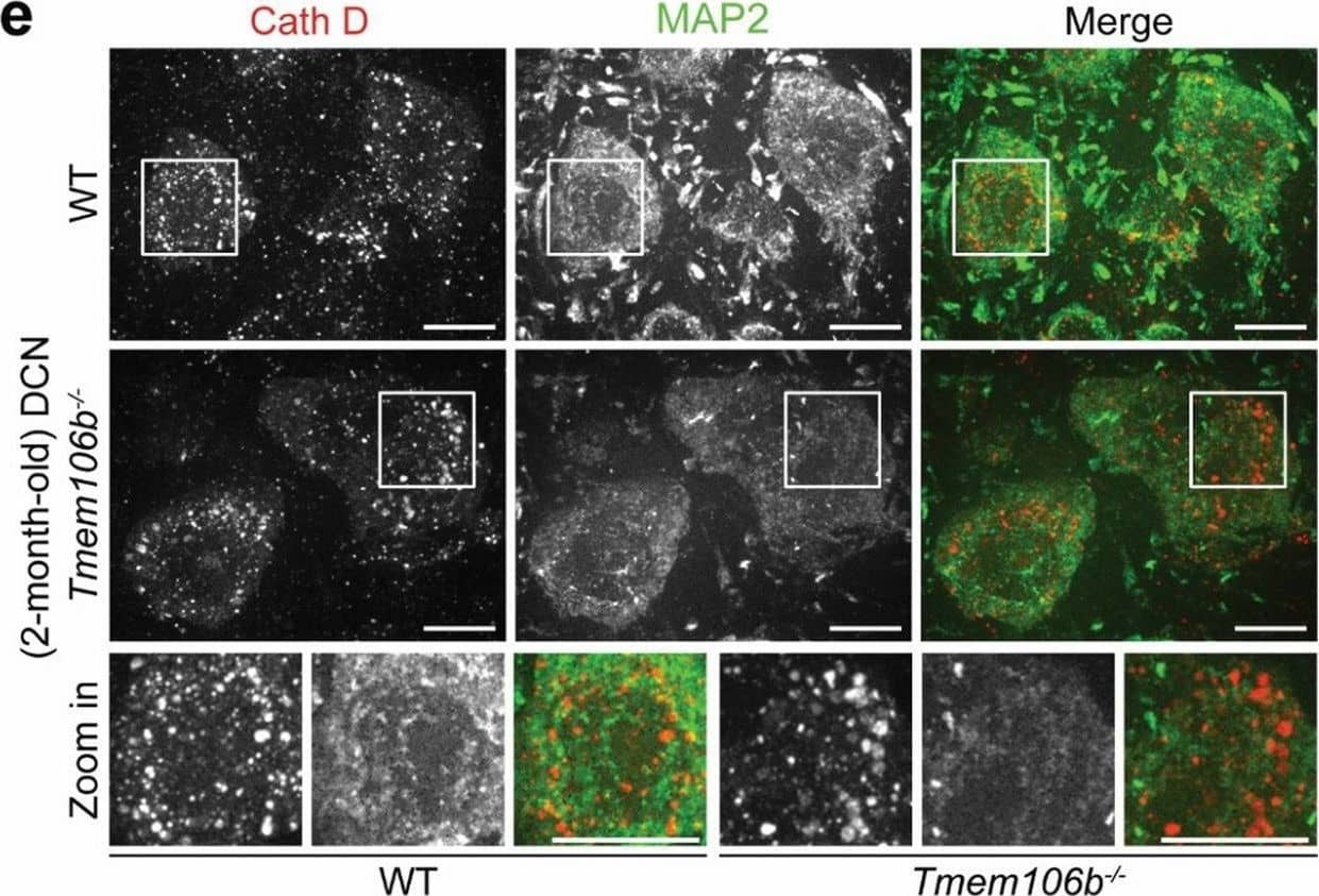Distinct lysosomal phenotypes among different types of neurons in the cerebellum of young Tmem106b−/− mice. a, b Immunostaining of PVALB and Cathepsin D (Cath D) in cerebellar sections from 2-month‐old WT and Tmem106b−/− mice. Representative images from the molecular cell layer are shown. The intensity of Cath D in PVALB-positive interneurons was quantified in b. n = 3. ****, p < 0.0001, unpaired t-test. Scale bar = 10 μm. c, d Immunostaining of Cathepsin D (Cath D) and Hoechst in cerebellar sections from 2-month‐old WT and Tmem106b−/− mice, and images were captured from granule cell layer. The intensity of Cath D in the granule cell layer was quantified in d. n = 3. **, p < 0.001, unpaired t-test. Scale bar = 10 μm. e, f Immunostaining of Cathepsin D (Cath D) and MAP2 in cerebellar sections from 2-month‐old WT and Tmem106b−/− mice. Representative images from the DCN region are shown. The intensity of Cath D in MAP2-positive DCN neurons was quantified in f. Zoom-in image shows the enlarged lysosomes in 2-month‐old Tmem106b−/− mice compared with WT mice. n = 3. ****, p < 0.0001, unpaired t-test. Scale bar = 10 μm Image collected and cropped by CiteAb from the following open publication (//pubmed.ncbi.nlm.nih.gov/35287730), licensed under a CC-BY license. Not internally tested by R&D Systems.
