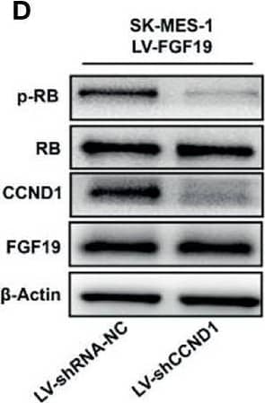 Western Blot FGF-19 Antibody [Unconjugated]
