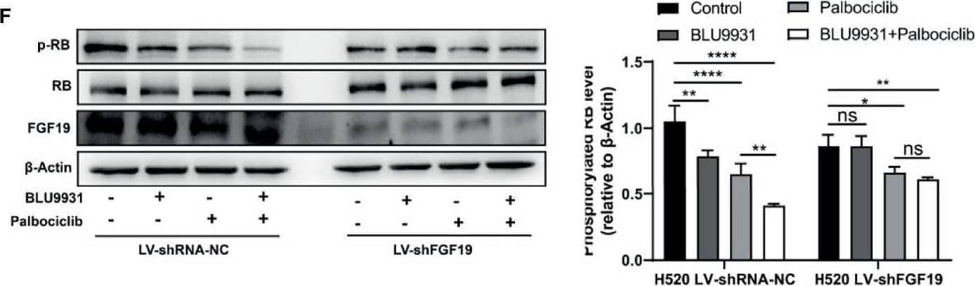 Western Blot FGF-19 Antibody [Unconjugated]