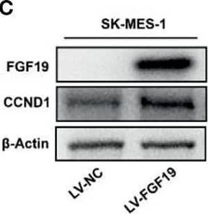 Western Blot FGF-19 Antibody [Unconjugated]