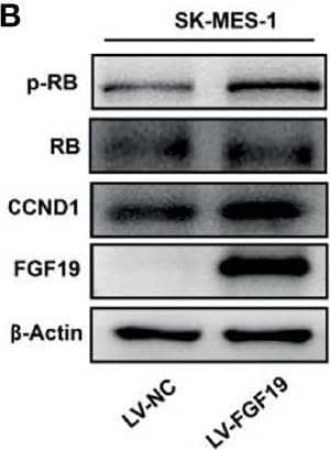 Western Blot FGF-19 Antibody [Unconjugated]