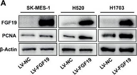 Western Blot FGF-19 Antibody [Unconjugated]