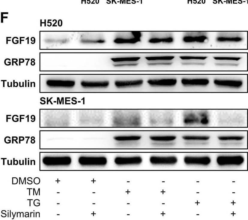Western Blot FGF-19 Antibody [Unconjugated]