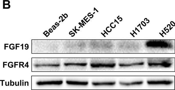 Western Blot FGF-19 Antibody [Unconjugated]