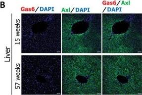 Gas6 & Axl expression in the cecal mucosa during K. pneumoniae infection decreases with aging.(A & B) Sections of cecal mucosa (A) or liver (B) were from mice aged 15 or 57 weeks at 2 days after infection with K. pneumoniae ATCC43816 pmCherry & immunostained with an anti-Gas6 antibody & an anti-Axl antibody. Each image has six independent replicates. Scale bar = 50 μm. (C) Detection of Axl, Gas6, ZO-1, & occludin by WBting. Cecum & liver tissues were collected, homogenized, & analyzed using an anti-Axl antibody, an anti-Gas6 antibody, an anti-ZO-1 antibody, or an anti-occludin antibody. Each lane of WBting images represents the protein from an individual mouse (mouse number = 5 (cecum) or 4 (liver) per group). Western blotting analysis represents three independent replicates. (D) Western blotting signal intensities were analyzed by ImageJ software. Each dot represents the value collected from an individual mouse (mouse number = 5 (cecum) or 4 (liver) per group). Data are presented as the mean ± SD. NS: not significant, *p < 0.05, **p < 0.01. p values were calculated by the Student’s t test. (E) Linear correlation between Gas6 expression & Axl expression in the cecum or liver of mice aged 15 (red circles) or 57 (blue circles) weeks infected with K. pneumoniae ATCC43816 pmCherry. Each dot represents an ELISA measured value of each protein sample collected from an individual mouse (mouse number = 5 per group). r > 0.70 & p < 0.05. (F) The population of CD11b+F4/80+ macrophages in the intestinal mucosa of young (14-week-old) & old (56-week-old) mice was examined by staining with anti-F4/80 & anti-CD11b antibodies. The percentage of F4/80-positive/CX3CR1-negative cells in 14-week-old & 56-week-old mice was 29.5% & 8.87%, respectively. Data are representative of four mice per group. Image collected & cropped by CiteAb from the following open publication (//pubmed.ncbi.nlm.nih.gov/37289655), licensed under a CC-BY license. Not internally tested by R&D Systems.