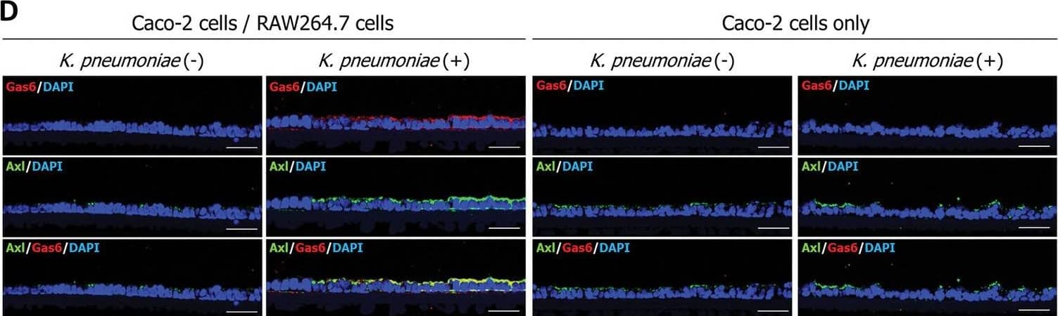 Gas6 released by macrophages that recognized K. pneumoniae infection is co-localized with Axl tyrosine kinase receptor on the epithelial cells.(A) Cytokine array analysis of the K. pneumoniae infection model based on the Transwell insert co-culture system consisting of Caco-2 cells and RAW264.7 macrophages. Quantification of Axl signals using a laser scanner. Each dot represents four independent replicates (n = 4 per group). Data are presented as the mean ± SD. **p < 0.01. p values were calculated by the Student’s t test. (B and C) Secretion of Axl (B) and Gas6 (C) by Caco-2 cells or RAW264.7 macrophages. Culture supernatants or lysates of K. pneumoniae were added to Caco-2 cells or RAW264.7 macrophages for 12 h. The culture media were then collected for ELISA analysis of Axl or Gas6 levels. Each dot represents six independent replicates (n = 6 per group). Data are presented as the mean ± SD. **p < 0.01. p values were calculated by one way analysis of variance. (D)K. pneumoniae-infected Caco-2 cells grown on a Transwell insert in the presence or absence of RAW264.7 macrophages were immunostained with anti-Gas6 and anti-Axl antibodies. Each image has six independent replicates. Scale bar = 50 μm. (E) Fluorescence intensity per pixel of anti-Axl antibody (left panel) or an anti-Gas6 antibody (right panel) were measured by the ImageJ analysis software. Each dot represents six independent replicates (n = 6 per group). Data are presented as the mean ± SD. **p < 0.01. p values were calculated by one way analysis of variance. Image collected and cropped by CiteAb from the following open publication (//pubmed.ncbi.nlm.nih.gov/37289655), licensed under a CC-BY license. Not internally tested by R&D Systems.