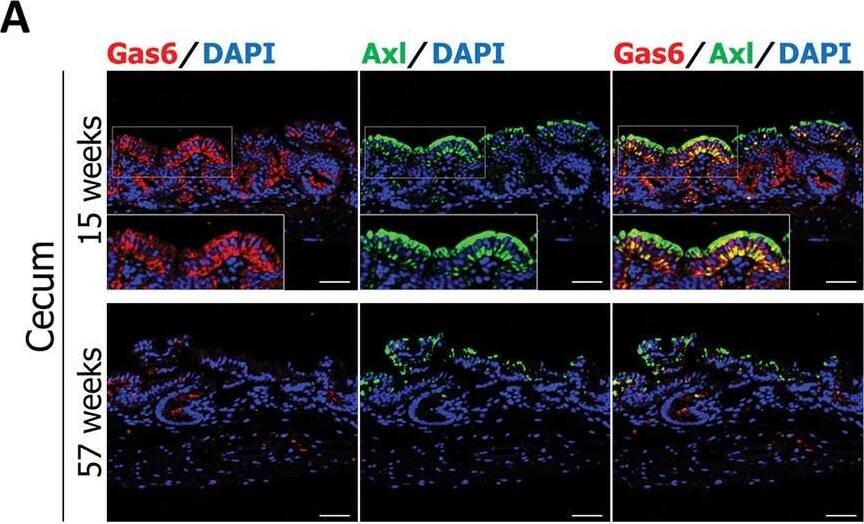 Gas6 & Axl expression in the cecal mucosa during K. pneumoniae infection decreases with aging.(A & B) Sections of cecal mucosa (A) or liver (B) were from mice aged 15 or 57 weeks at 2 days after infection with K. pneumoniae ATCC43816 pmCherry & immunostained with an anti-Gas6 antibody & an anti-Axl antibody. Each image has six independent replicates. Scale bar = 50 μm. (C) Detection of Axl, Gas6, ZO-1, & occludin by WBting. Cecum & liver tissues were collected, homogenized, & analyzed using an anti-Axl antibody, an anti-Gas6 antibody, an anti-ZO-1 antibody, or an anti-occludin antibody. Each lane of WBting images represents the protein from an individual mouse (mouse number = 5 (cecum) or 4 (liver) per group). Western blotting analysis represents three independent replicates. (D) Western blotting signal intensities were analyzed by ImageJ software. Each dot represents the value collected from an individual mouse (mouse number = 5 (cecum) or 4 (liver) per group). Data are presented as the mean ± SD. NS: not significant, *p < 0.05, **p < 0.01. p values were calculated by the Student’s t test. (E) Linear correlation between Gas6 expression & Axl expression in the cecum or liver of mice aged 15 (red circles) or 57 (blue circles) weeks infected with K. pneumoniae ATCC43816 pmCherry. Each dot represents an ELISA measured value of each protein sample collected from an individual mouse (mouse number = 5 per group). r > 0.70 & p < 0.05. (F) The population of CD11b+F4/80+ macrophages in the intestinal mucosa of young (14-week-old) & old (56-week-old) mice was examined by staining with anti-F4/80 & anti-CD11b antibodies. The percentage of F4/80-positive/CX3CR1-negative cells in 14-week-old & 56-week-old mice was 29.5% & 8.87%, respectively. Data are representative of four mice per group. Image collected & cropped by CiteAb from the following open publication (//pubmed.ncbi.nlm.nih.gov/37289655), licensed under a CC-BY license. Not internally tested by R&D Systems.