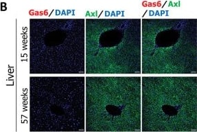 Gas6 & Axl expression in the cecal mucosa during K. pneumoniae infection decreases with aging.(A & B) Sections of cecal mucosa (A) or liver (B) were from mice aged 15 or 57 weeks at 2 days after infection with K. pneumoniae ATCC43816 pmCherry & immunostained with an anti-Gas6 antibody & an anti-Axl antibody. Each image has six independent replicates. Scale bar = 50 μm. (C) Detection of Axl, Gas6, ZO-1, & occludin by WBting. Cecum & liver tissues were collected, homogenized, & analyzed using an anti-Axl antibody, an anti-Gas6 antibody, an anti-ZO-1 antibody, or an anti-occludin antibody. Each lane of WBting images represents the protein from an individual mouse (mouse number = 5 (cecum) or 4 (liver) per group). Western blotting analysis represents three independent replicates. (D) Western blotting signal intensities were analyzed by ImageJ software. Each dot represents the value collected from an individual mouse (mouse number = 5 (cecum) or 4 (liver) per group). Data are presented as the mean ± SD. NS: not significant, *p < 0.05, **p < 0.01. p values were calculated by the Student’s t test. (E) Linear correlation between Gas6 expression & Axl expression in the cecum or liver of mice aged 15 (red circles) or 57 (blue circles) weeks infected with K. pneumoniae ATCC43816 pmCherry. Each dot represents an ELISA measured value of each protein sample collected from an individual mouse (mouse number = 5 per group). r > 0.70 & p < 0.05. (F) The population of CD11b+F4/80+ macrophages in the intestinal mucosa of young (14-week-old) & old (56-week-old) mice was examined by staining with anti-F4/80 & anti-CD11b antibodies. The percentage of F4/80-positive/CX3CR1-negative cells in 14-week-old & 56-week-old mice was 29.5% & 8.87%, respectively. Data are representative of four mice per group. Image collected & cropped by CiteAb from the following open publication (//pubmed.ncbi.nlm.nih.gov/37289655), licensed under a CC-BY license. Not internally tested by R&D Systems.