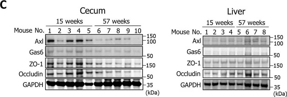 Gas6 & Axl expression in the cecal mucosa during K. pneumoniae infection decreases with aging.(A & B) Sections of cecal mucosa (A) or liver (B) were from mice aged 15 or 57 weeks at 2 days after infection with K. pneumoniae ATCC43816 pmCherry & immunostained with an anti-Gas6 antibody & an anti-Axl antibody. Each image has six independent replicates. Scale bar = 50 μm. (C) Detection of Axl, Gas6, ZO-1, & occludin by WBting. Cecum & liver tissues were collected, homogenized, & analyzed using an anti-Axl antibody, an anti-Gas6 antibody, an anti-ZO-1 antibody, or an anti-occludin antibody. Each lane of WBting images represents the protein from an individual mouse (mouse number = 5 (cecum) or 4 (liver) per group). Western blotting analysis represents three independent replicates. (D) Western blotting signal intensities were analyzed by ImageJ software. Each dot represents the value collected from an individual mouse (mouse number = 5 (cecum) or 4 (liver) per group). Data are presented as the mean ± SD. NS: not significant, *p  0.70 & p  0.70 & p  0.70 & p  0.70 & p  0.70 & p  0.70 & p < 0.05. (F) The population of CD11b+F4/80+ macrophages in the intestinal mucosa of young (14-week-old) & old (56-week-old) mice was examined by staining with anti-F4/80 & anti-CD11b antibodies. The percentage of F4/80-positive/CX3CR1-negative cells in 14-week-old & 56-week-old mice was 29.5% & 8.87%, respectively. Data are representative of four mice per group. Image collected & cropped by CiteAb from the following open publication (//pubmed.ncbi.nlm.nih.gov/37289655), licensed under a CC-BY license. Not internally tested by R&D Systems.