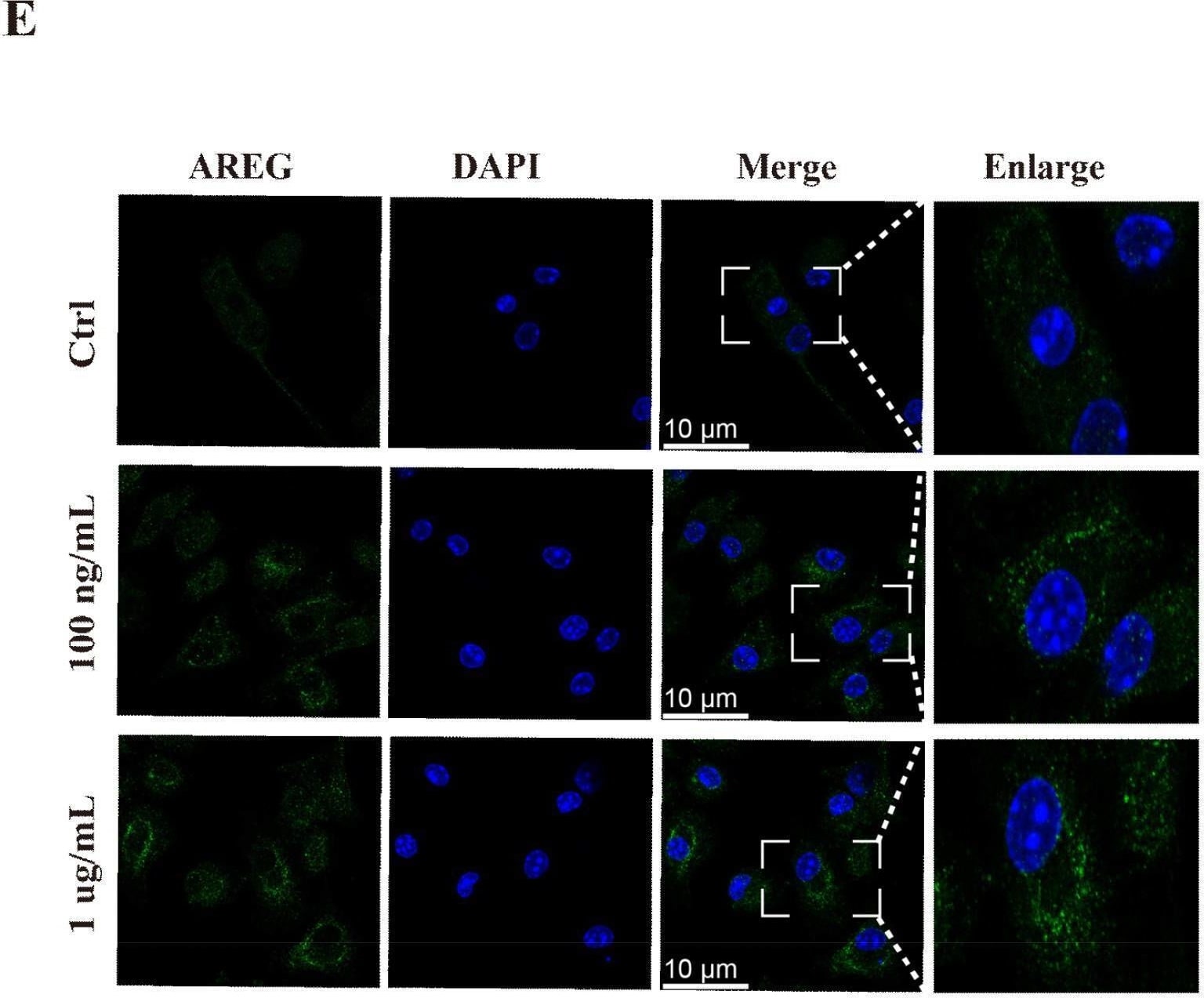 Dynamic expression of AREG in sepsis. RAW264.7 cells were stimulated with LPS (100 ng/mL or 1 μg/mL) for 1, 3, 6, 12, and 24 h. AREG mRNA and protein expressions were detected using RT-PCR and ELISA (A-C). WT C57BL/6 mice were intraperitoneally injected with LPS (20 mg/kg) and constructed with the CLP model, whereas AREG protein expression in serum was detected via ELISA (D). BMDM was stimulated with LPS (100 ng/mL or 1 μg/mL) for 12 h, and AREG protein expression was detected via Immunofluorescence (E). Data presented as mean ± SEM (n ≥ 3). *P < 0.05, **P < 0.01, ***P < 0.001 vs. Control. AREG, amphiregulin; WT, wild type; BMDM, bone marrow-derived macrophages; CLP, cecal ligation and puncture. Image collected and cropped by CiteAb from the following open publication (//pubmed.ncbi.nlm.nih.gov/40292295), licensed under a CC-BY license. Not internally tested by R&D Systems.