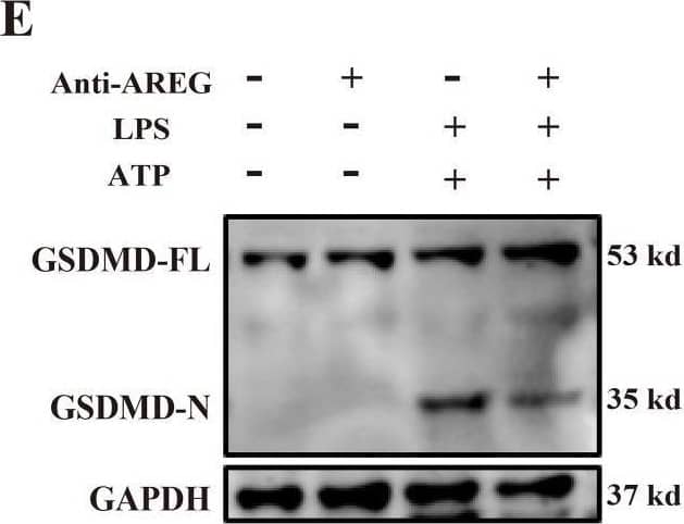 Neutralizing extracellular AREG decreases LPS-induced TLR4 expression and pyroptosis in macrophages. LPS-induced BMDM was pretreated with a neutralizing antibody of AREG. p-EGFR, TLR4, and GSDMD-N expression levels were detected via Western blot and immunofluorescence (A-C, E, F), TLR4 expression and ASC oligomerization was detected through immunofluorescence (D, G, H). Formation of pyrosomes (red arrows) was detected using electron microscopy, scale bars, 2 μm (I). Data are presented as mean ± SEM (n ≥ 3).*P < 0.05, **P < 0.01, ***P < 0.001 vs. Control. AREG, amphiregulin. Image collected and cropped by CiteAb from the following open publication (//pubmed.ncbi.nlm.nih.gov/40292295), licensed under a CC-BY license. Not internally tested by R&D Systems.