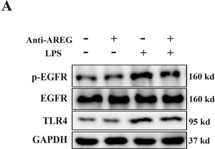 Neutralizing extracellular AREG decreases LPS-induced TLR4 expression and pyroptosis in macrophages. LPS-induced BMDM was pretreated with a neutralizing antibody of AREG. p-EGFR, TLR4, and GSDMD-N expression levels were detected via Western blot and immunofluorescence (A-C, E, F), TLR4 expression and ASC oligomerization was detected through immunofluorescence (D, G, H). Formation of pyrosomes (red arrows) was detected using electron microscopy, scale bars, 2 μm (I). Data are presented as mean ± SEM (n ≥ 3).*P < 0.05, **P < 0.01, ***P < 0.001 vs. Control. AREG, amphiregulin. Image collected and cropped by CiteAb from the following open publication (//pubmed.ncbi.nlm.nih.gov/40292295), licensed under a CC-BY license. Not internally tested by R&D Systems.