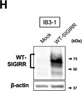 Western Blot SIGIRR Antibody [Unconjugated]