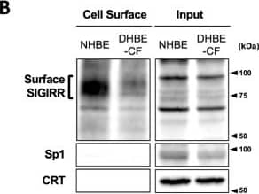 The expression of the cell surface of the SIGIRR is downregulated in CF cells. (A,B) Cell surface expression of the SIGIRR in (A) C38 and IB3-1, (B) NHBE and DHBE-CF (non-CF vs. CF) airway epithelial cells were assessed by biotinylation assay, followed by immunoblotting using anti-SIGIRR, calreticulin (CRT) and Sp1 antibodies. Protein bands in (A) were scanned, and relative band intensities were normalized to the  beta -actin band. The graphs represent the average relative band intensity with S.D. from four independent experiments. * p < 0.05; Student’s t-test (n = 3). (C) Flow cytometry for the SIGIRR was performed using C38 and IB3-1 cells. Surface expressions of the SIGIRR were indicated by a fluorescence shift compared to the isotype control antibody (dotted line). Image collected and cropped by CiteAb from the following open publication (//pubmed.ncbi.nlm.nih.gov/35887095), licensed under a CC-BY license. Not internally tested by R&D Systems.