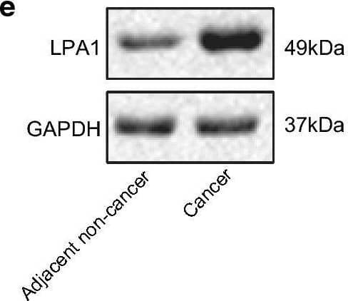 miR-367 downregulates LPA1 expression. a Bioinformatics prediction of binding sites for miR-367 and LPA1. b Luminescence activity of LPA1 by dual luciferase reporter gene assay. c RIP assay detection of the binding of miR-367 and LPA1 to Ago2. d Detection of relative expression of LPA1 in cancer tissues and adjacent normal tissues by RT-qPCR. e Analysis of protein level of LPA1 in cancer and adjacent normal tissues by western blot analysis. f Statistical expression of protein level of LPA1. g Correlation analysis between miR-367 and LPA1. h RT-qPCR results of the relative expression level of LPA1 in each group of cells. i Western blot analysis of LPA1 protein levels in each group of cells. j Statistical protein expression level of LPA1. Measurement data were expressed as mean ± standard deviation. Data in compliance with normal distribution and homogeneity between two groups were compared using t test. Comparisons among multiple groups were conducted by one-way ANOVA followed by Tukey’s post hoc test. *p < 0.05 vs. normal tissues or cells; #p < 0.05 vs. Inhibitor NC The experiment was repeated three times independently Image collected and cropped by CiteAb from the following open publication (//pubmed.ncbi.nlm.nih.gov/33024414), licensed under a CC-BY license. Not internally tested by R&D Systems.