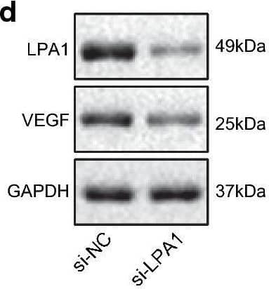 Low expression of LPA1 inhibits tumorigenic ability of ovarian cancer in nude mice. a Volume of mice tumor. b Weight of mice tumor. c RT-qPCR detection results of mRNA levels of related factors in tumor tissues. d Western blot analysis of the protein levels of related factors in tumor tissues. e Statistical graph of protein levels of related factors. f Immunohistochemistry for detecting CD34 expression (200×). Measurement data were expressed as mean ± standard deviation. Data in compliance with normal distribution and homogeneity between two groups were compared using t test. Comparisons among multiple groups were conducted by one-way ANOVA followed by Tukey’s post hoc test. Statistics of tumor volume at different time points was analyzed using repeated measures ANOVA. *p < 0.05 vs. normal tissues or cells. The experiment was repeated three times independently Image collected and cropped by CiteAb from the following open publication (//pubmed.ncbi.nlm.nih.gov/33024414), licensed under a CC-BY license. Not internally tested by R&D Systems.