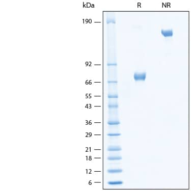 2 μg/lane of Recombinant Human B7-H3 Fc Chimera Alexa Fluor® 488 Protein (Catalog # AFG1027) was resolved with SDS-PAGE under reducing (R) and non-reducing (NR) conditions and visualized by Coomassie® Blue staining, showing bands at 70-80 kDa and 140-160 kDa, respectively.