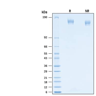 2 μg/lane of Recombinant SARS-CoV-2 P.1 Spike (GCN4-IZ) His-tag Alexa Fluor® 488 Protein (Catalog # AFG10795) was resolved with SDS-PAGE under reducing (R) and non-reducing (NR) conditions and visualized by Coomassie® Blue staining, showing bands at 140-170 kDa.