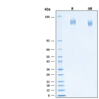 2 μg/lane of Recombinant SARS-CoV-2 B.1.617.2 S Alexa Fluor® 488 Protein (AFG10878) was resolved with SDS-PAGE under reducing (R) and non-reducing (NR) conditions and visualized by Coomassie® Blue staining, showing bands at 144-170 kDa.