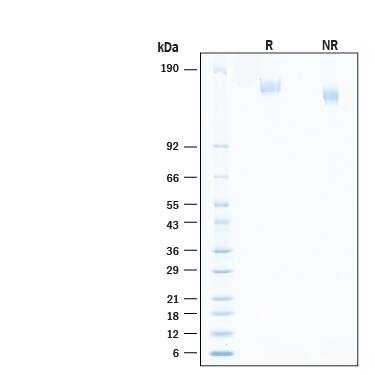 2 μg/lane of Recombinant SARS-CoV-2 B.1.1.529 Spike (GCN4-IZ) His-tag Alexa Fluor® 488 Protein (Catalog # AFG11061) was resolved with SDS-PAGE under reducing (R) and non-reducing (NR) conditions and visualized by Coomassie® Blue staining, showing bands at 145-175 kDa.