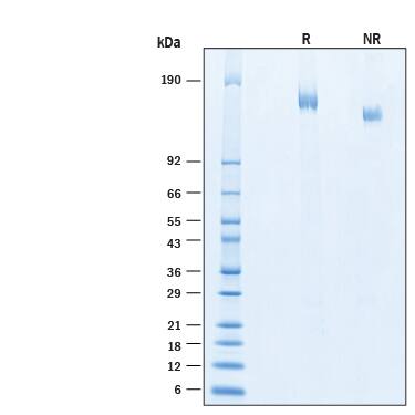 2 μg/lane of Recombinant SARS-CoV-2 BA.2 Spike (GCN4-IZ) His-tag Alexa Fluor® 488 Protein (Catalog # AFG11109) was resolved with SDS-PAGE under reducing (R) and non-reducing (NR) conditions and visualized by Coomassie® Blue staining, showing bands at 144- 172 kDa.