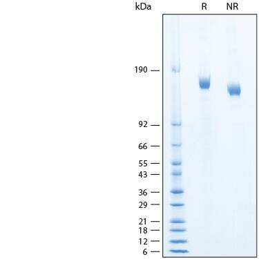 2 μg/lane of Recombinant SARS-CoV-2 BA.4/BA.5 S Alexa Fluor® 488 Protein (Catalog # AFG11231) was resolved with SDS-PAGE under reducing (R) and non-reducing (NR) conditions and visualized by Coomassie® Blue staining, showing bands at 141-170 kDa.