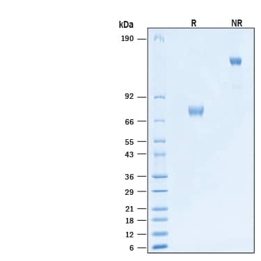 2 μg/lane of Recombinant Human Siglec-3/CD33 Fc Alexa Fluor® 488 Protein (Catalog # AFG1137) was resolved with SDS-PAGE under reducing (R) and non-reducing (NR) conditions and visualized by Coomassie® Blue staining, showing bands at 67-85 kDa and 130-170 kDa, respectively.