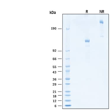 2 μg/lane of Recombinant Human Siglec‑2/CD22 Fc Chimera Alexa Fluor® 488 Protein (Catalog # AFG1968) was resolved with SDS-PAGE under reducing (R) and non-reducing (NR) conditions and visualized by Coomassie® Blue staining, showing bands at 128-141 kDa and 256-282 kDa, respectively.