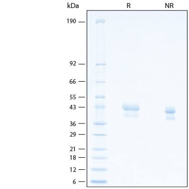 2 μg/lane of Recombinant Human Mesothelin C-Terminal (aa 296‑580) His‑tag Alexa Fluor® 488 Protein (Catalog # AFG3265) was resolved with SDS-PAGE under reducing (R) and non-reducing (NR) conditions and visualized by Coomassie® Blue staining, showing bands at 40-45 kDa.
