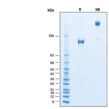 2 μg/lane of Recombinant Human VEGFR2/KDR Fc His Alexa Fluor® 488 Protein (Catalog # AFG357) was resolved with SDS-PAGE under reducing (R) and non-reducing (NR) conditions and visualized by Coomassie® Blue staining, showing bands at 150-170 kDa and 300-340 kDa, respectively.