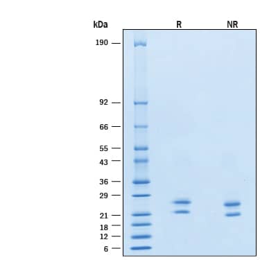 2 μg/lane of Recombinant Human GITR Ligand/TNFSF18 (GCN4-IZ) Alexa Fluor® 488 Protein (Catalog # AFG6987) was resolved with SDS-PAGE under reducing (R) and non-reducing (NR) conditions and visualized by Coomassie® Blue staining, showing bands at 20-27 kDa.