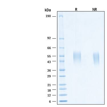 2 μg/lane of Recombinant Human B7‑1/CD80 His-tag Alexa Fluor® 488 Protein (Catalog # AFG9050) was resolved with SDS-PAGE under reducing (R) and non-reducing (NR) conditions and visualized by Coomassie® Blue staining, showing bands at 45-58 kDa.