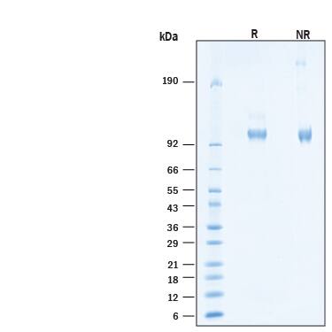 2 μg/lane of Recombinant Human ACE‑2 His-tag Alexa Fluor® 488 Protein (Catalog # AFG933) was resolved with SDS-PAGE under reducing (R) and non-reducing (NR) conditions and visualized by Coomassie® Blue staining, showing bands at 101-111 kDa.