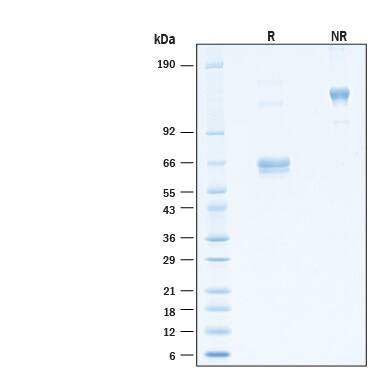 2 μg/lane of Recombinant Human EMMPRIN/CD147 Fc Chimera His-tag Alexa Fluor® 488 Protein (Catalog # AFG972) was resolved with SDS-PAGE under reducing (R) and non-reducing (NR) conditions and visualized by Coomassie® Blue staining, showing bands at 56-69 kDa and 112-140 kDa, respectively.