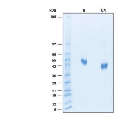 2 μg/lane of Recombinant Human DLL3 His-tag Alexa Fluor® 488 Protein (Catalog # AFG9749) was resolved with SDS-PAGE under reducing (R) and non-reducing (NR) conditions and visualized by Coomassie® Blue staining, showing bands at 48-57 kDa.