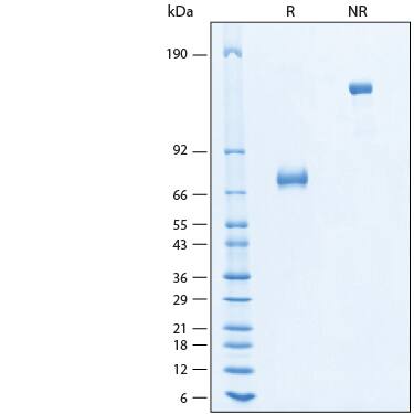 2 μg/lane of Recombinant Human B7-H3 Fc Chimera Alexa Fluor® 647 Protein (Catalog # AFR1027) was resolved with SDS-PAGE under reducing (R) and non-reducing (NR) conditions and visualized by Coomassie® Blue staining, showing bands at 70-80 kDa and 140-160 kDa, respectively.